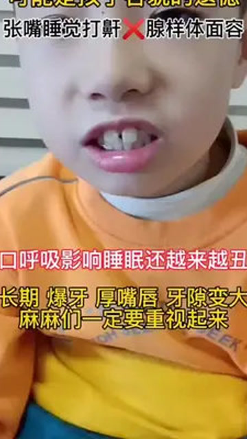 孩子长期张嘴睡觉时间久了上排牙齿突出容易形成龅牙,所以得及时矫正