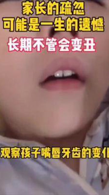 孩子张嘴睡觉要及时纠正,久了会变丑呦,等嘴凸了就不好看咯#闭嘴贴