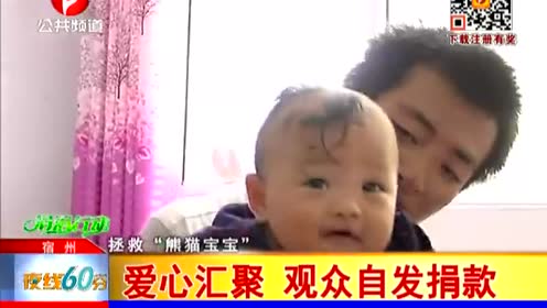 兽皮痣新闻 腾讯视频