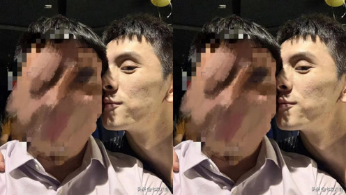 李佳琦酒后与男性亲密合照,皮肤粗糙满脸痘印,嘴唇却保养极好!