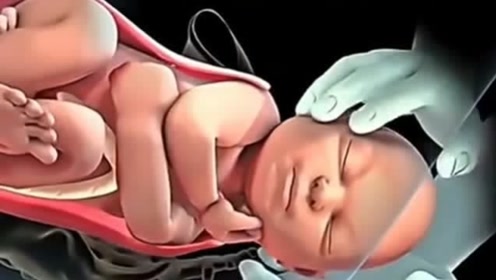 3d动画还原婴儿出生,十几根肋骨同时断裂的疼痛,生过孩子才能体会!