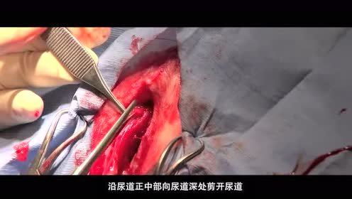 惨!桂林一拖拉机与小车相撞,现场视频曝光!