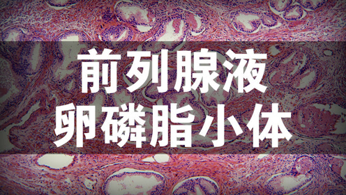 前列腺液中的卵磷脂小体和白细胞是什么,怎么用它来判断前列腺炎