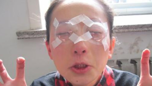 手术矫正过视力的人,后面眼睛会有什么问题?看完后不敢去做了