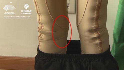 女子抽脂后腰不对称腿麻痹,杭州格莱美表示:恢复期过后再协商