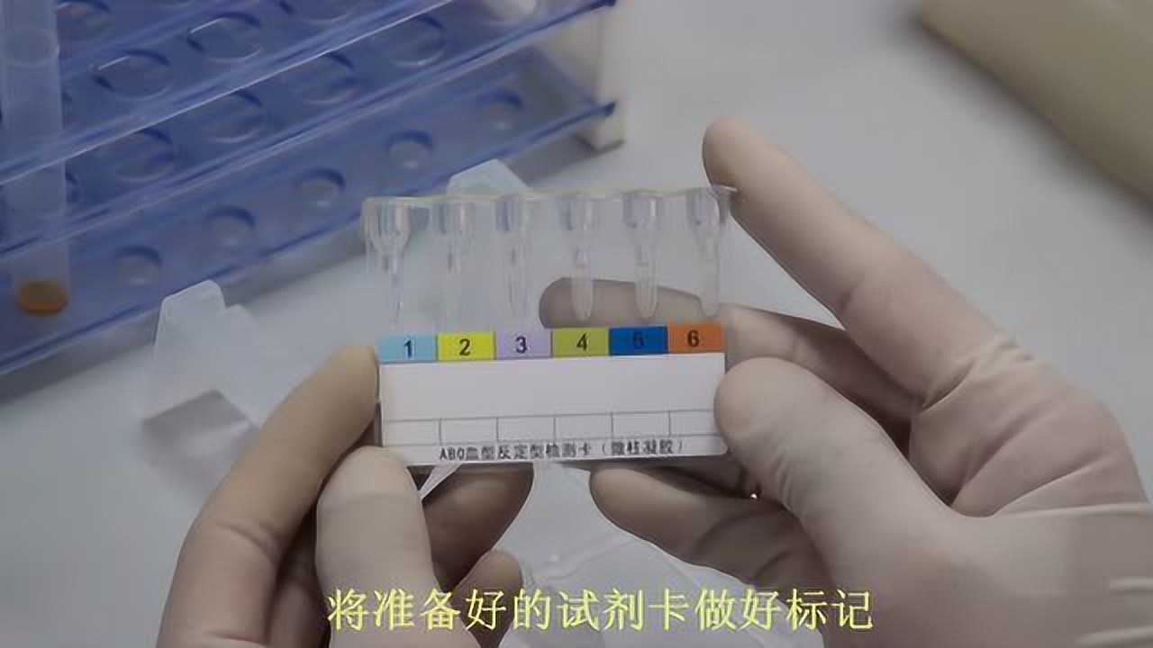 三倍流畅播放 4k超清体验 01:37 abo血型反定型检测卡(微柱凝胶)