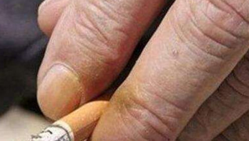 经常吸烟手指发黄怎么办?教你1个小技巧,轻松去掉手指烟渍!