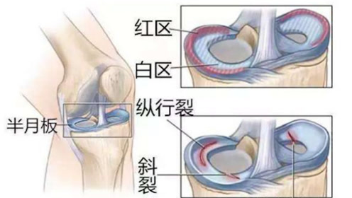 腾讯视频