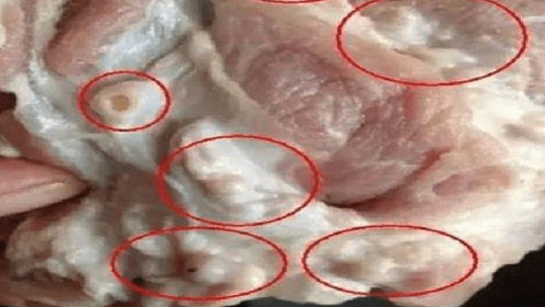 人身上寄生虫 腾讯视频