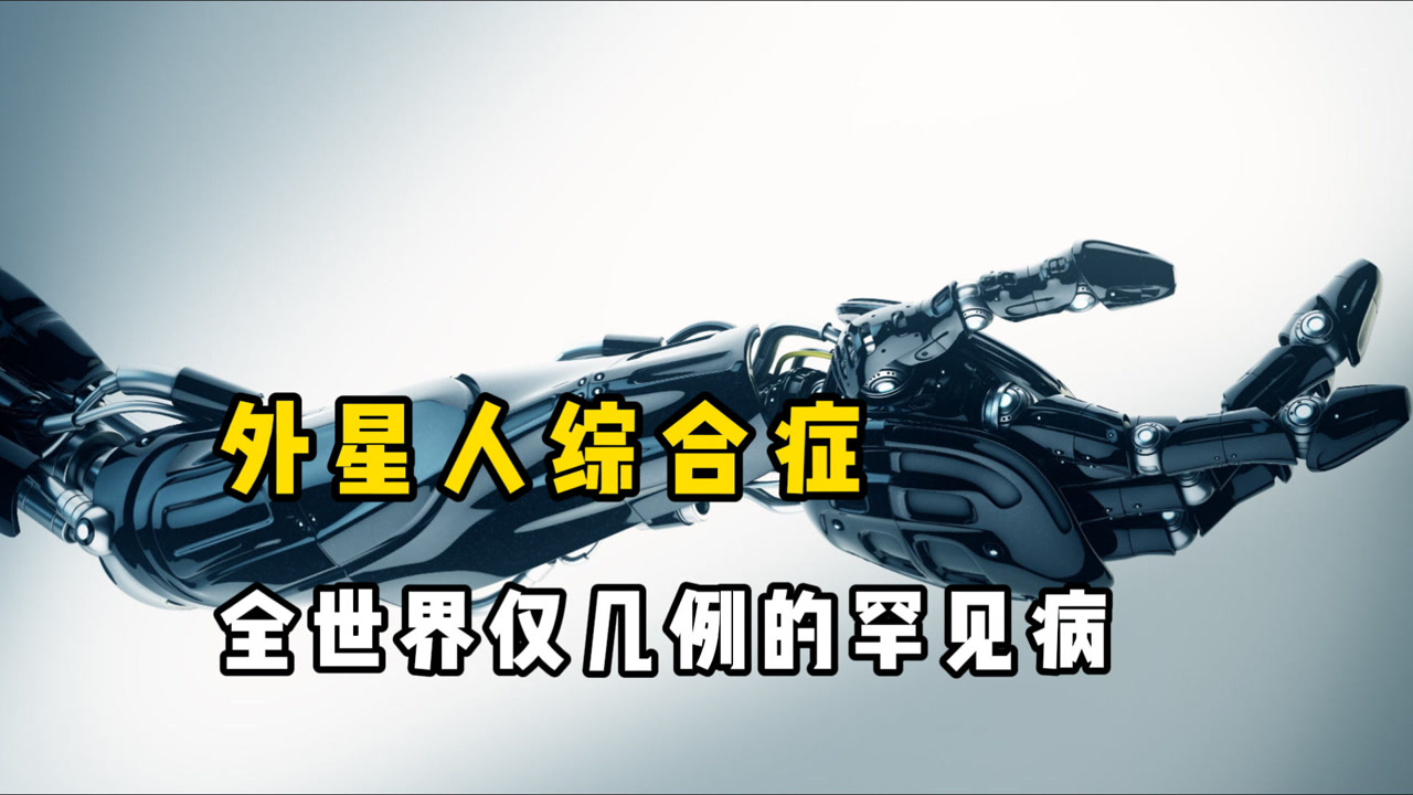 你知道"外星人综合症"吗?全世界仅几例的罕见病,让人手不由己