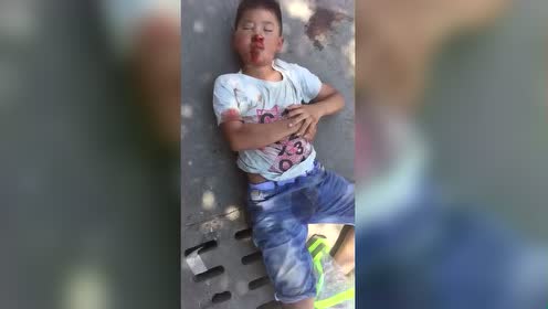 小孩摔跤,急寻家属