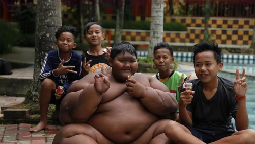 世界上最胖的小孩,十岁体重达到420斤,减肥后表皮太恐怖了!