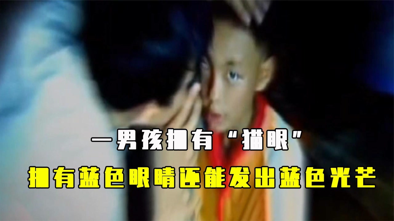 一男孩惊现"猫眼,不仅拥有蓝色的眼睛,眼球还能发出蓝色光芒