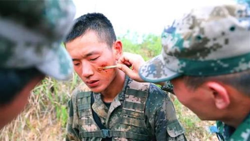为什么征兵时不要有"伤疤"的人?背后的原因不简单