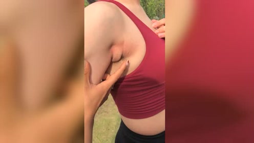 多乳症副乳 腾讯视频