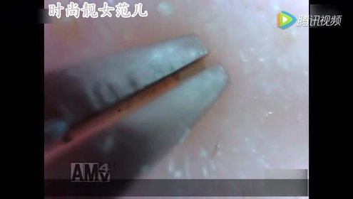 间:2016-09-09上传者:时尚女人范儿0:15:11印度街边理发店,还有挤黑头