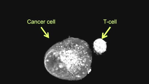 显微镜显示了t细胞如何杀死癌细胞
