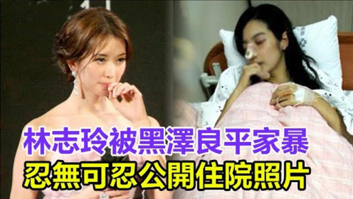 林志玲被黑澤良平家暴,忍無可忍公開住院照片,真相大白让人唏嘘