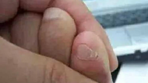 为什么中国人的小脚趾大多都有两瓣指甲?答案让人想不到