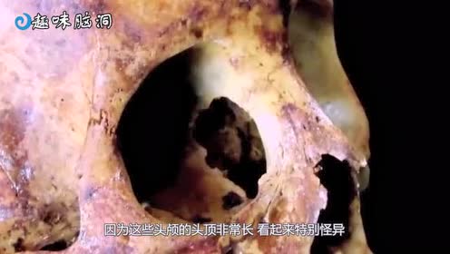 国外发现"外星人"头骨!专家检测完dna后!答案让人没想到!