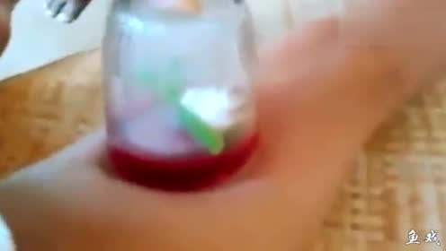 女子拔火罐感到身体"火辣辣" 医院诊断:二度烧伤