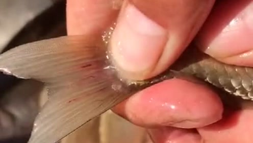 人身上的寄生虫 腾讯视频