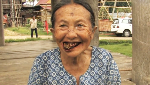 连续吃5年槟榔,对身体会有什么影响?现在知道还不晚!