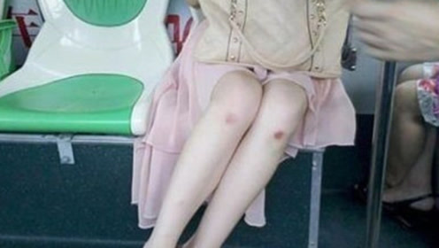 女生膝盖上的"淤青",到底是怎么来的?答案和你想的一样!