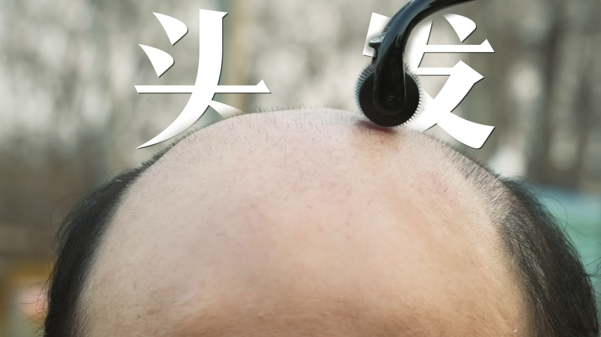秃然发生：一个被凝视的男人的世界-封面1