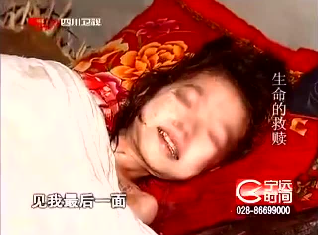 十岁女孩怪病全身溃烂长满蛆虫父母不管不问全村集资抓回她父母
