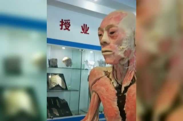 22真实人体标本浸泡了福尔马林之后的样子太可怕了