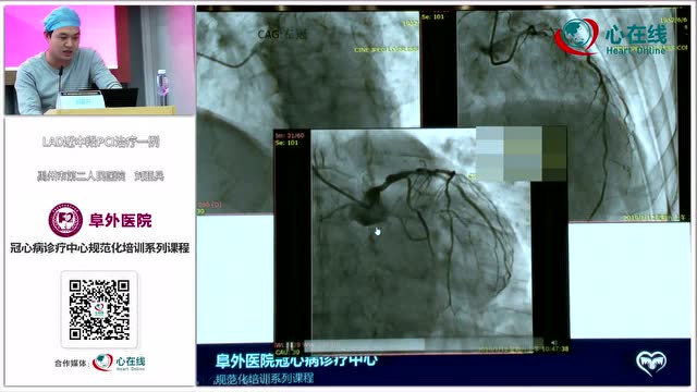 阜外介入課程劉亞兵