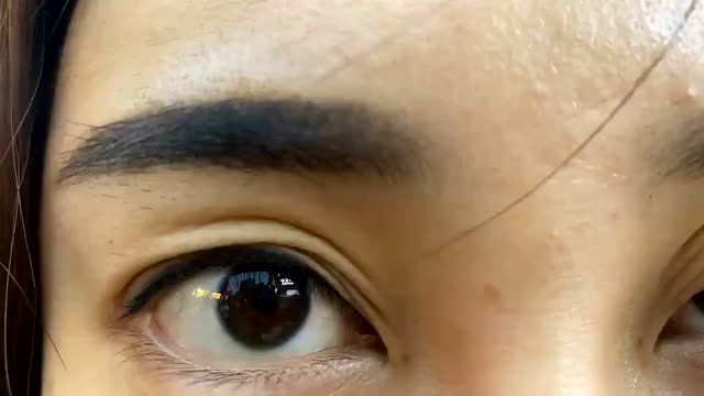 被蚊子叮到眼皮