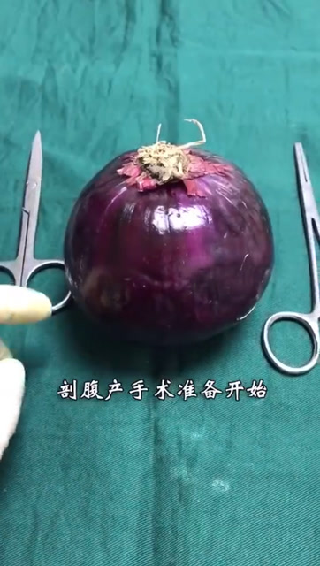 剖腹產和順產的區別,不疼是假的