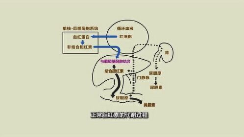 正常胆红素代谢