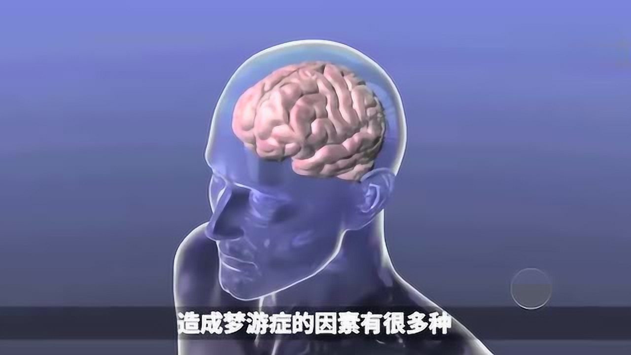 梦游是种病吗为什么有的人睡觉时会梦游呢