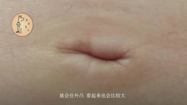 孕妈肚脐眼“变大”和腹中的男宝有关?其实变大的不只是肚脐眼