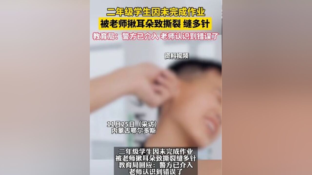 学生未完成作业被老师揪耳朵致撕裂