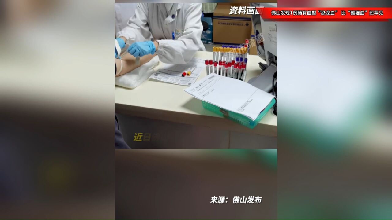 全国罕见!佛山发现1例稀有血型“恐龙血”,比“熊猫血”还罕见!