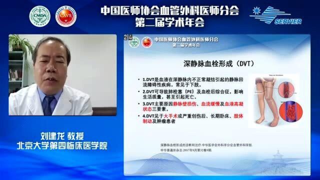 血管资讯发布刘建龙:急性DVT诊治的几个热点问题探讨