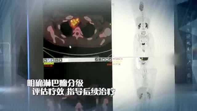 QTV2《健康青岛》|生命雷达指引健康之路