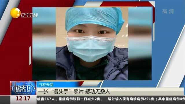 一张“馒头手”照片,感动无数人