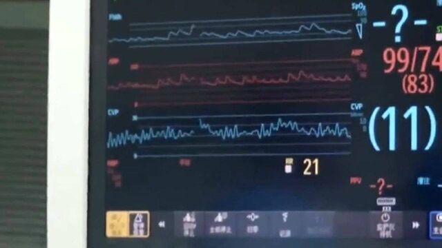 ICU — 维护生命的最后阵地