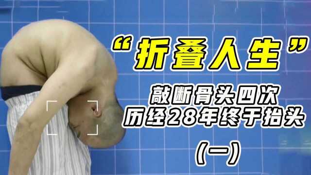 “折叠人”李华:身体蜷缩不到90厘米,敲断骨头4次,28年后治愈#电影种草指南大赛#