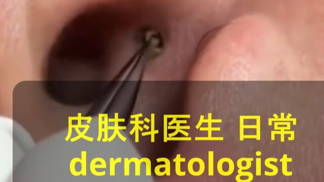 小赵英语:皮肤科医生日常 Dermatologist