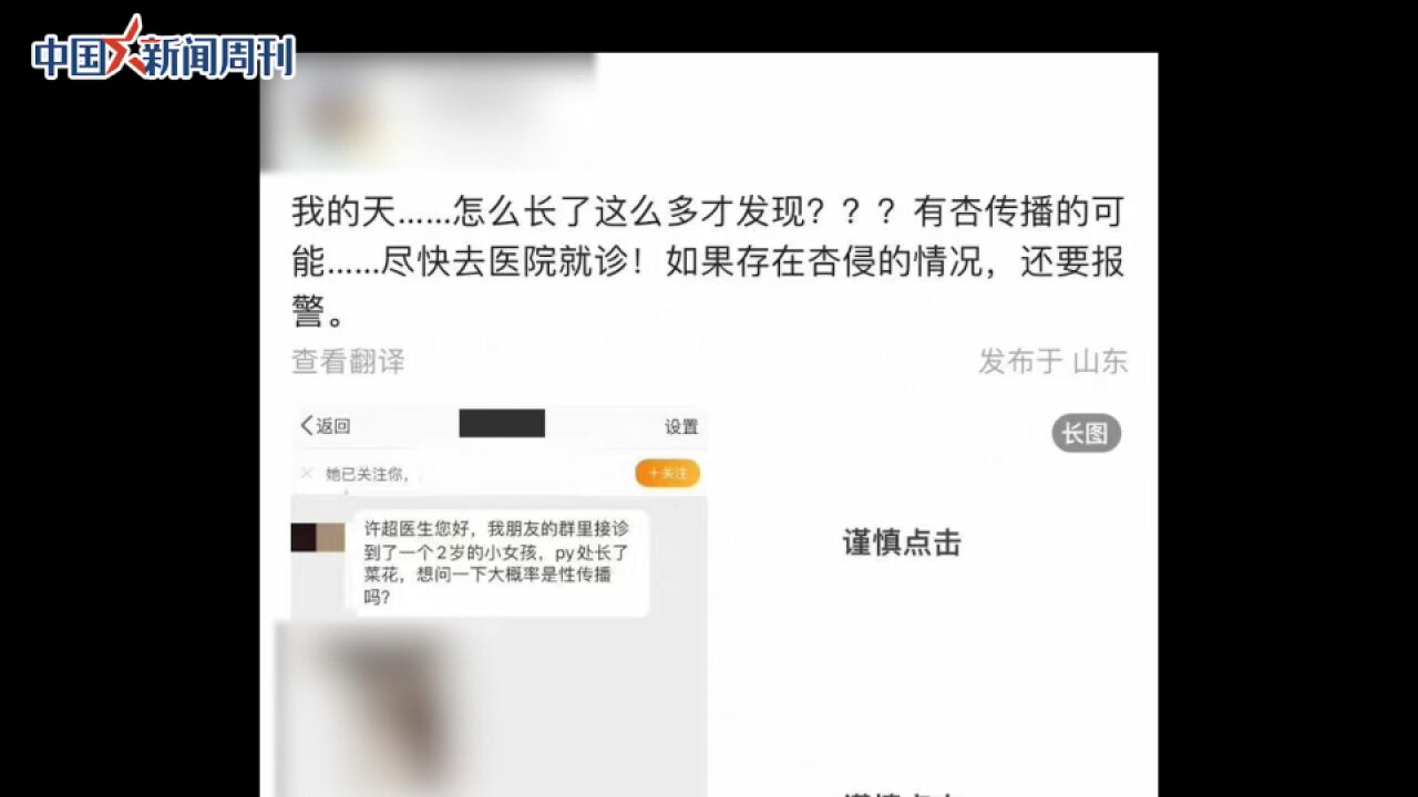 妇联回应2岁女童疑患尖锐湿疣:女童已得到治疗