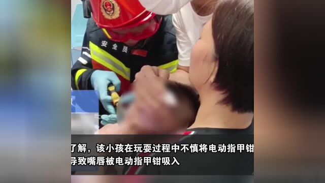 惊险!1岁小孩嘴唇被电动指甲钳卡住 东莞消防火速救援