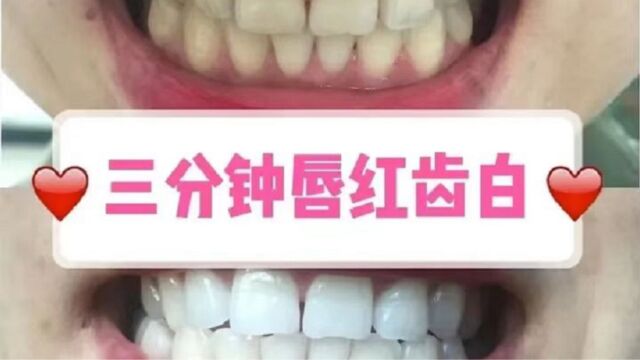 白牙界的领先者!每天3分钟就能刷出一口大白牙!