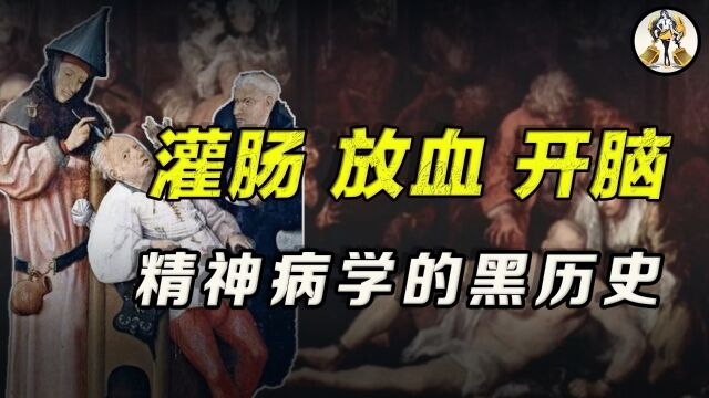 灌肠、放血、脑子开瓢,精神病黑暗史有多反人类?