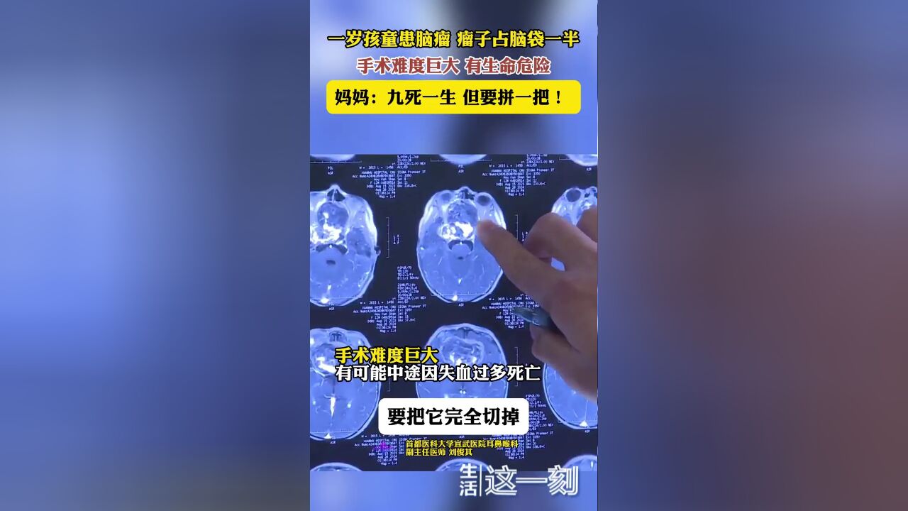 一岁孩童患脑瘤占脑袋一半 手术难度巨大 妈妈哭着说“要拼一把!”